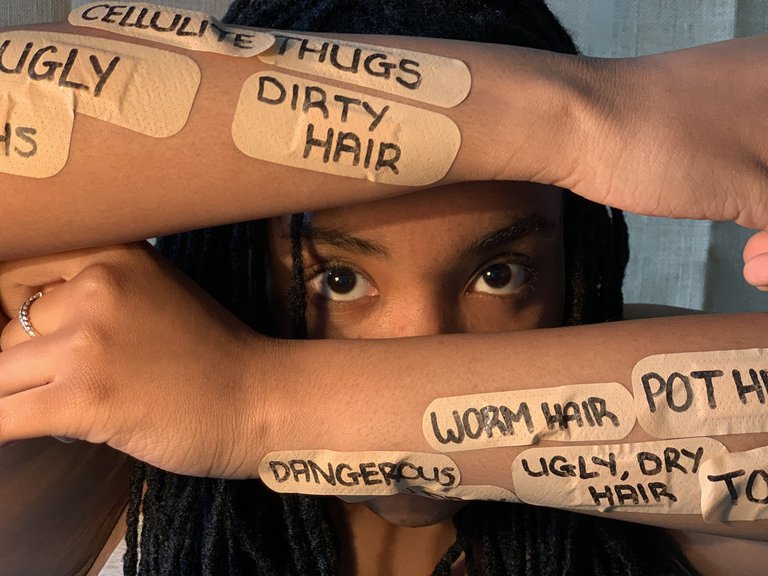 Girl facing camera with band-aids on arms containi